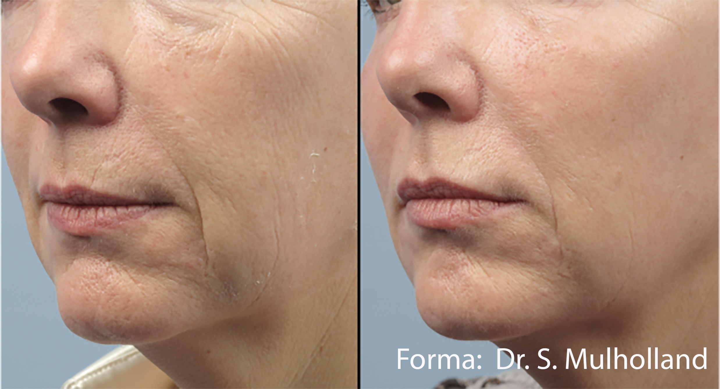 67c251579035f6792457a57f_forma-before-after-dr-s-mulholland-preview-1